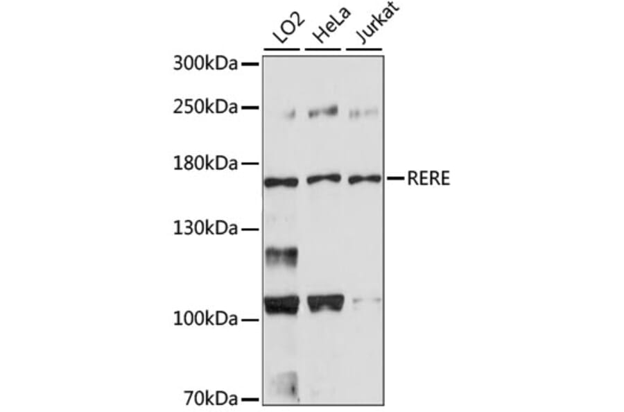 Western Blot - Anti-RERE Antibody (A88498) - Antibodies.com