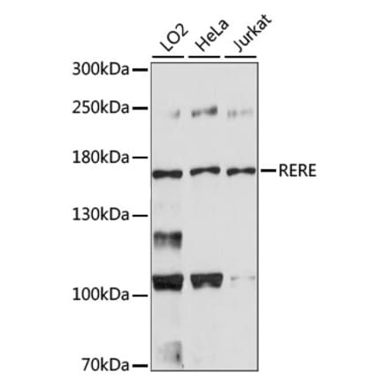 Western Blot - Anti-RERE Antibody (A88498) - Antibodies.com