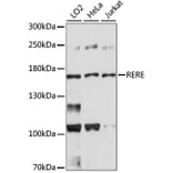 Western Blot - Anti-RERE Antibody (A88498) - Antibodies.com