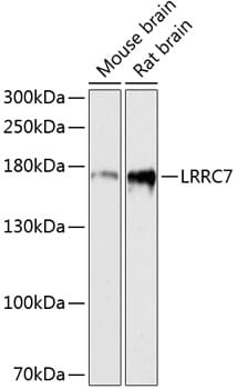 Western blot analysis of extracts of various cell lines, using Anti-LRRC7 Antibody (A13114) at 1:3000 dilution.
Secondary antibody: Goat Anti-Rabbit IgG (H+L) (HRP) (AS014) at 1:10,000 dilution.
Lysates / proteins: 25µg per lane.
Blocking buffer: 3% non-fat dry milk in TBST.
Detection: ECL Basic Kit (RM00020).
Exposure time: 90s.