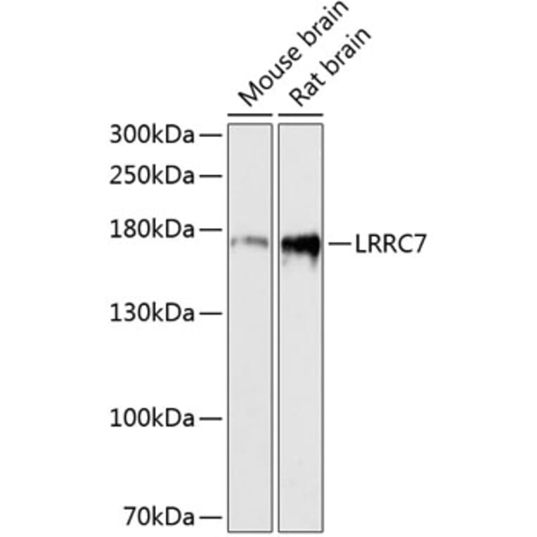 Western Blot - Anti-LRRC7 Antibody (A88499) - Antibodies.com