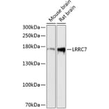 Western Blot - Anti-LRRC7 Antibody (A88499) - Antibodies.com