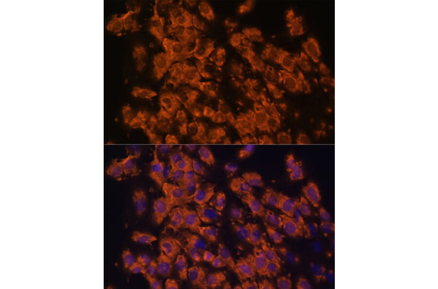 Immunofluorescence - Anti-LRRC7 Antibody (A88499) - Antibodies.com