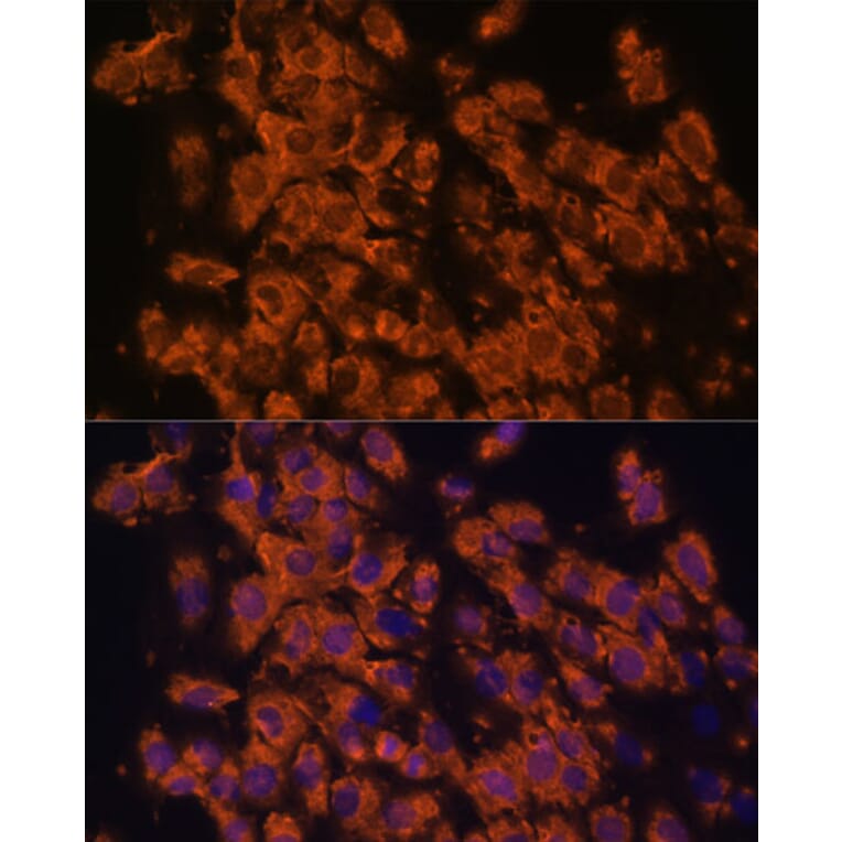 Immunofluorescence - Anti-LRRC7 Antibody (A88499) - Antibodies.com