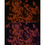 Immunofluorescence - Anti-LRRC7 Antibody (A88499) - Antibodies.com