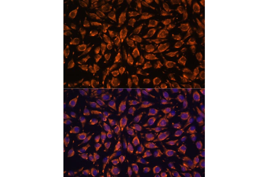 Immunofluorescence - Anti-LRRC7 Antibody (A88499) - Antibodies.com