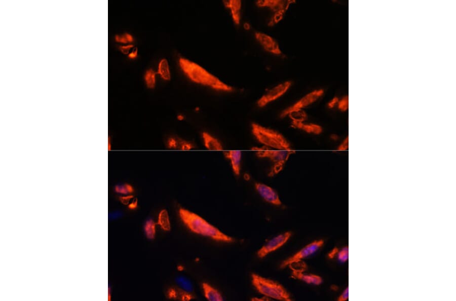 Immunofluorescence - Anti-LRRC7 Antibody (A88499) - Antibodies.com