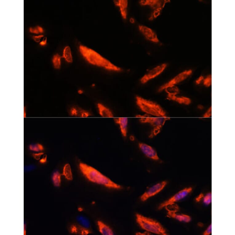 Immunofluorescence - Anti-LRRC7 Antibody (A88499) - Antibodies.com