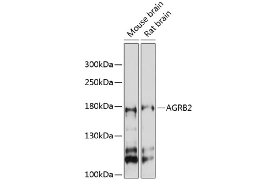 Western Blot - Anti-BAI2 Antibody (A88500) - Antibodies.com