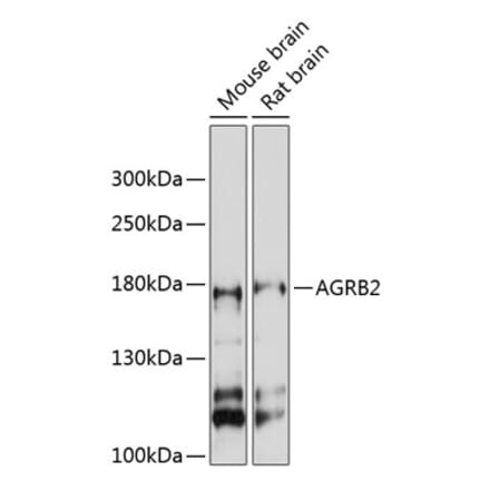 Western Blot - Anti-BAI2 Antibody (A88500) - Antibodies.com