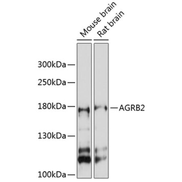 Western Blot - Anti-BAI2 Antibody (A88500) - Antibodies.com