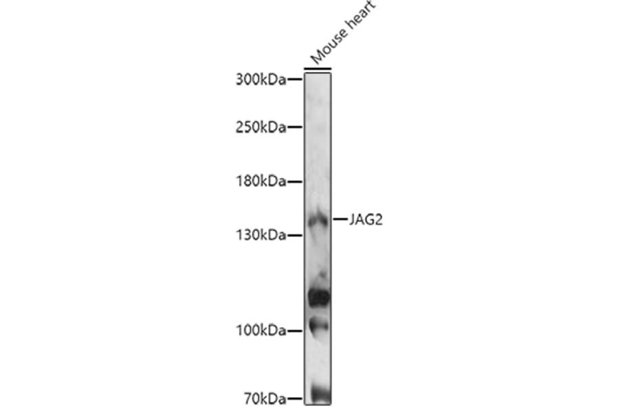 Western Blot - Anti-Jagged 2/JAG2 Antibody (A88503) - Antibodies.com