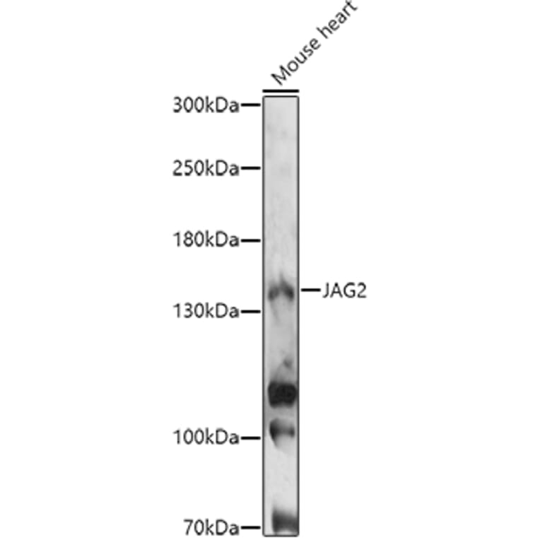 Western Blot - Anti-Jagged 2/JAG2 Antibody (A88503) - Antibodies.com