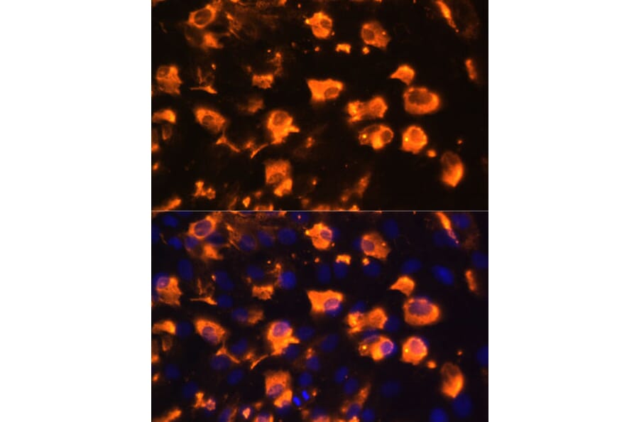 Immunofluorescence - Anti-Jagged 2/JAG2 Antibody (A88503) - Antibodies.com