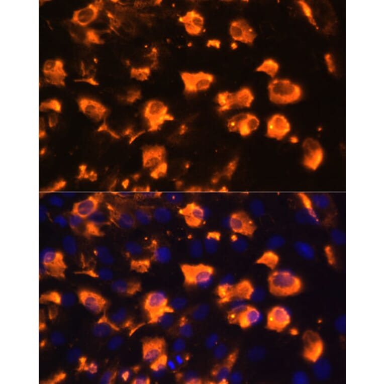 Immunofluorescence - Anti-Jagged 2/JAG2 Antibody (A88503) - Antibodies.com