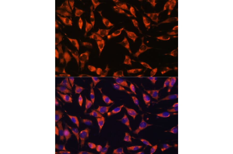 Immunofluorescence - Anti-Jagged 2/JAG2 Antibody (A88503) - Antibodies.com