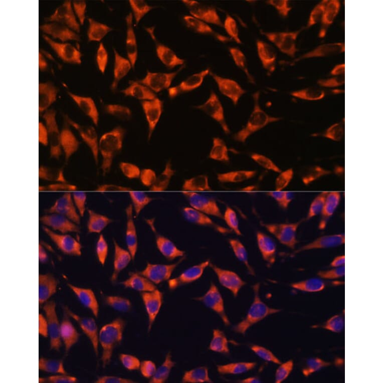 Immunofluorescence - Anti-Jagged 2/JAG2 Antibody (A88503) - Antibodies.com