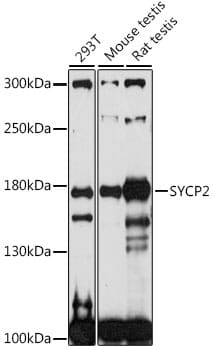 Western blot analysis of extracts of various cell lines, using Anti-SYCP2 Antibody (A16098) at 1:1,000 dilution.
Secondary antibody: Goat Anti-Rabbit IgG (H+L) (HRP) (AS014) at 1:10,000 dilution.
Lysates / proteins: 25µg per lane.
Blocking buffer: 3% non-fat dry milk in TBST.
Detection: ECL Basic Kit (RM00020).
Exposure time: 90s.