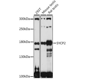 Western Blot - Anti-SYCP2 Antibody (A88505) - Antibodies.com