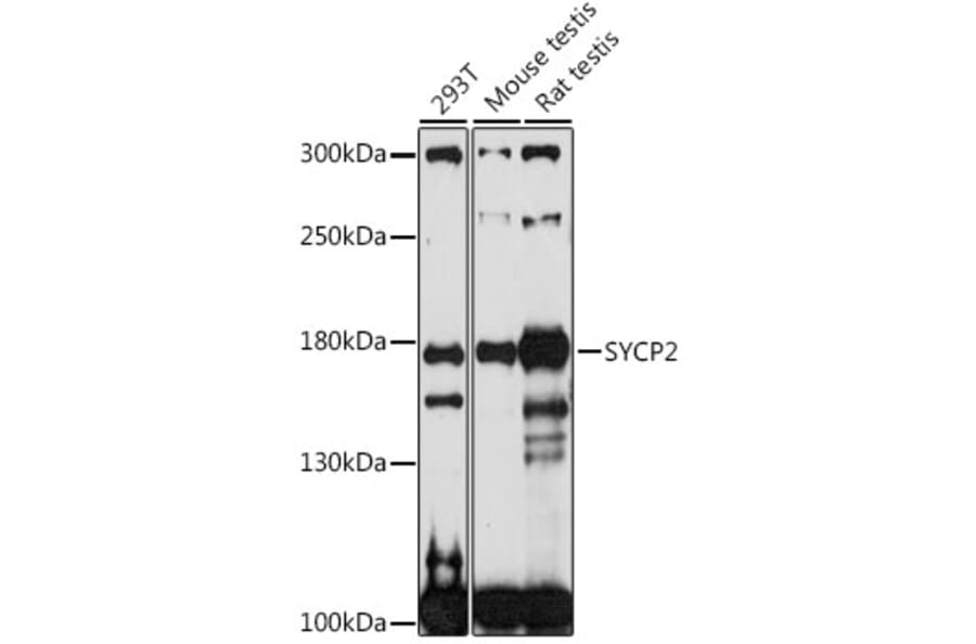 Western Blot - Anti-SYCP2 Antibody (A88505) - Antibodies.com
