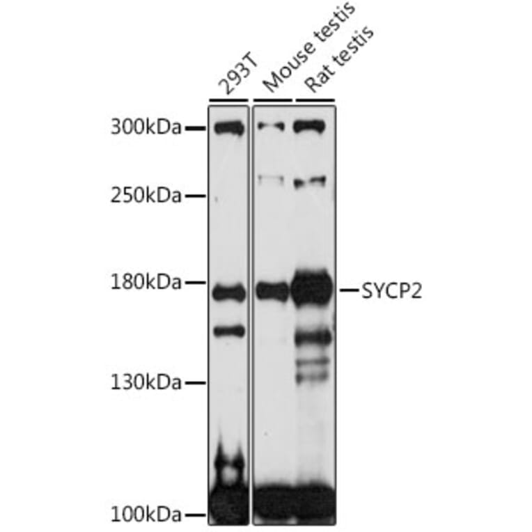 Western Blot - Anti-SYCP2 Antibody (A88505) - Antibodies.com