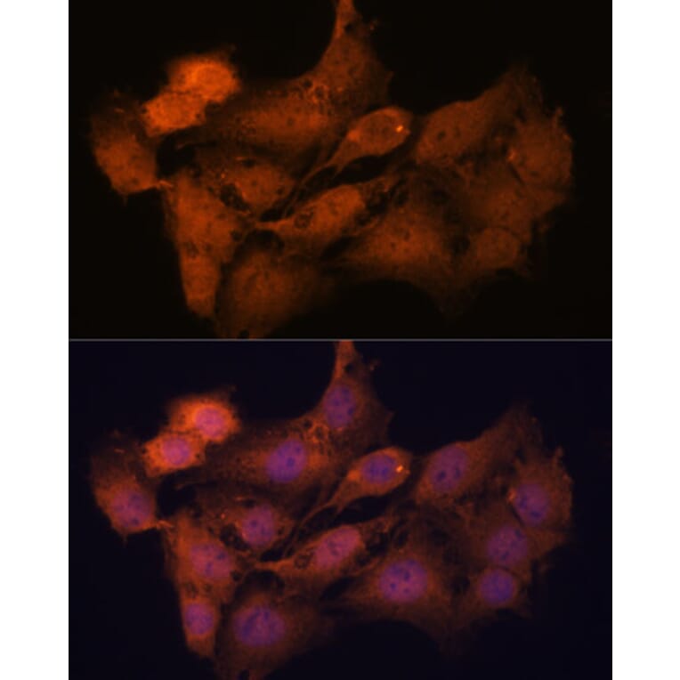 Immunofluorescence - Anti-SYCP2 Antibody (A88505) - Antibodies.com