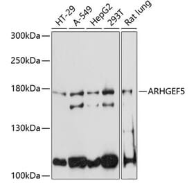 Western Blot - Anti-ARHGEF5 Antibody (A88506) - Antibodies.com