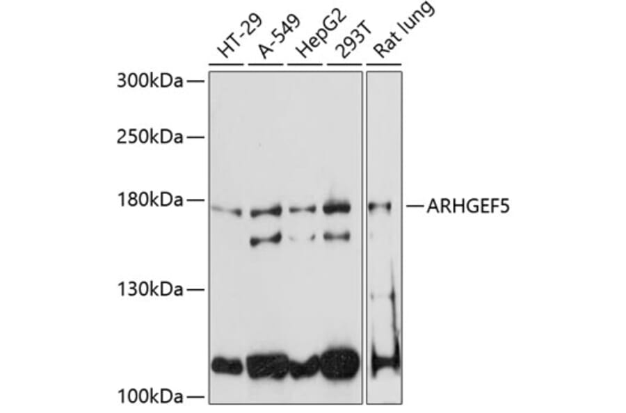Western Blot - Anti-ARHGEF5 Antibody (A88506) - Antibodies.com