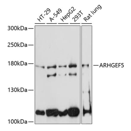 Western Blot - Anti-ARHGEF5 Antibody (A88506) - Antibodies.com