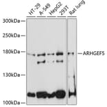 Western Blot - Anti-ARHGEF5 Antibody (A88506) - Antibodies.com