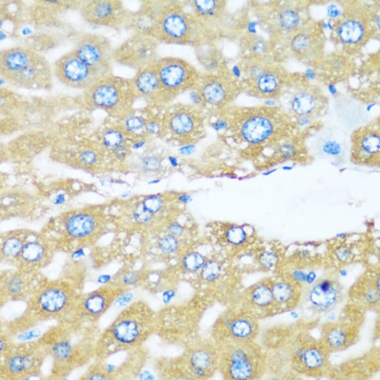 Immunohistochemistry - Anti-ARHGEF5 Antibody (A88506) - Antibodies.com