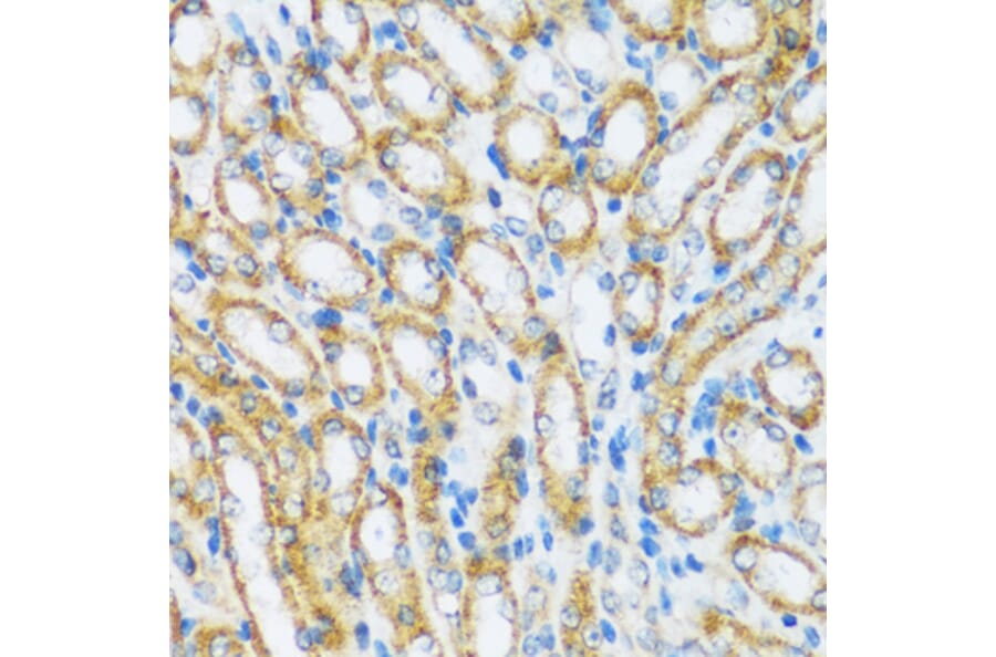Immunohistochemistry - Anti-ARHGEF5 Antibody (A88506) - Antibodies.com