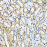 Immunohistochemistry - Anti-ARHGEF5 Antibody (A88506) - Antibodies.com