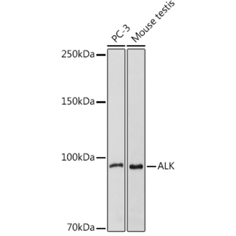 Western Blot - Anti-ALK Antibody (A88507) - Antibodies.com