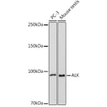 Western Blot - Anti-ALK Antibody (A88507) - Antibodies.com