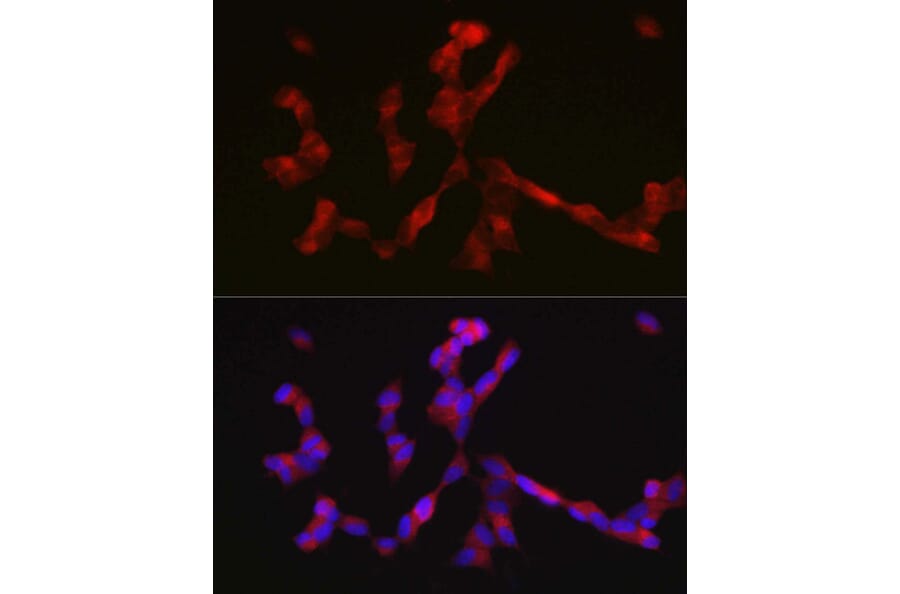 Immunofluorescence - Anti-ALK Antibody (A88507) - Antibodies.com