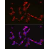 Immunofluorescence - Anti-ALK Antibody (A88507) - Antibodies.com