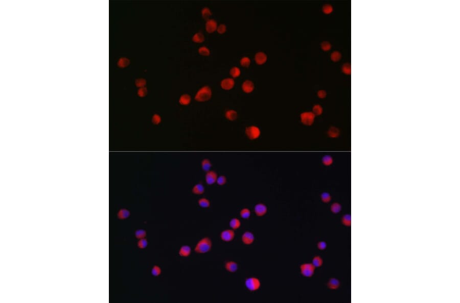 Immunofluorescence - Anti-ALK Antibody (A88507) - Antibodies.com