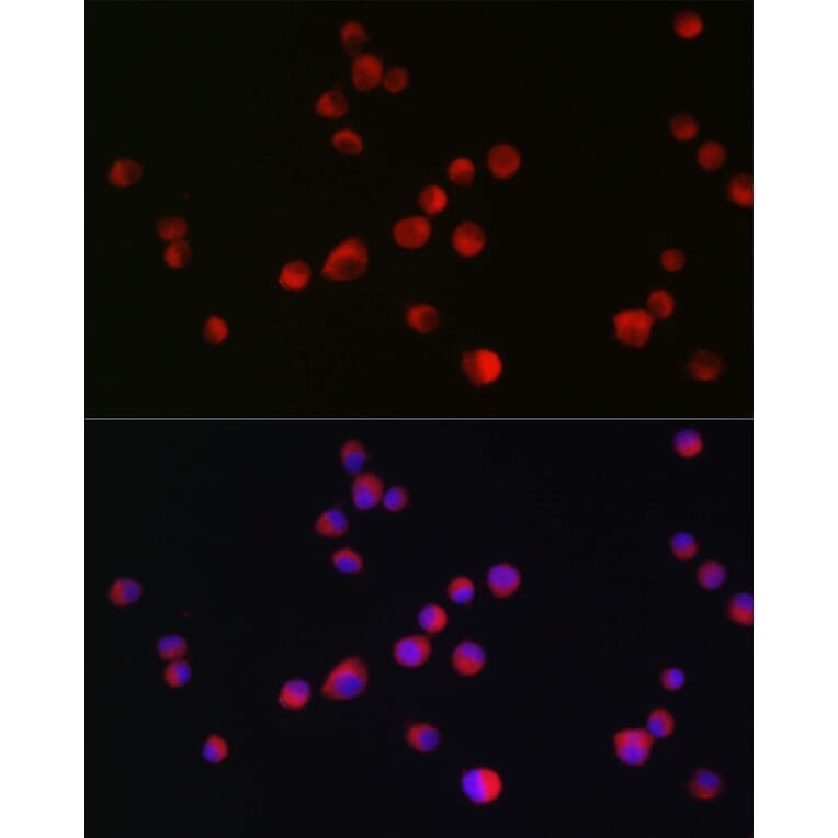 Immunofluorescence - Anti-ALK Antibody (A88507) - Antibodies.com