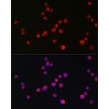Immunofluorescence - Anti-ALK Antibody (A88507) - Antibodies.com