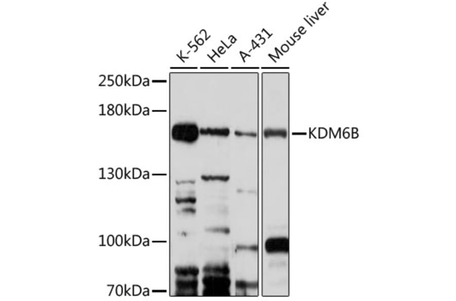 Western Blot - Anti-KDM6B / JMJD3 Antibody (A88509) - Antibodies.com