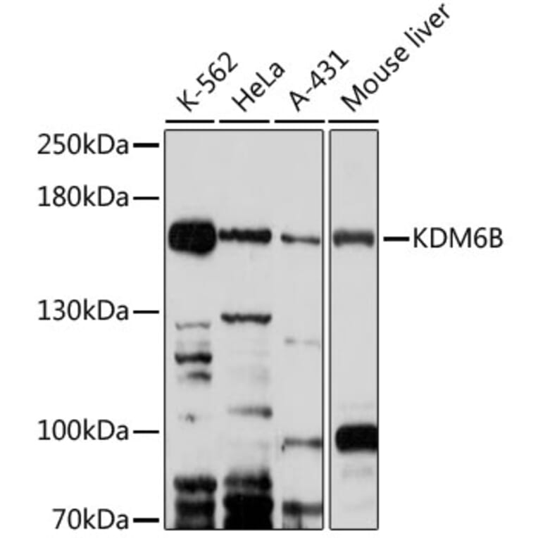 Western Blot - Anti-KDM6B / JMJD3 Antibody (A88509) - Antibodies.com