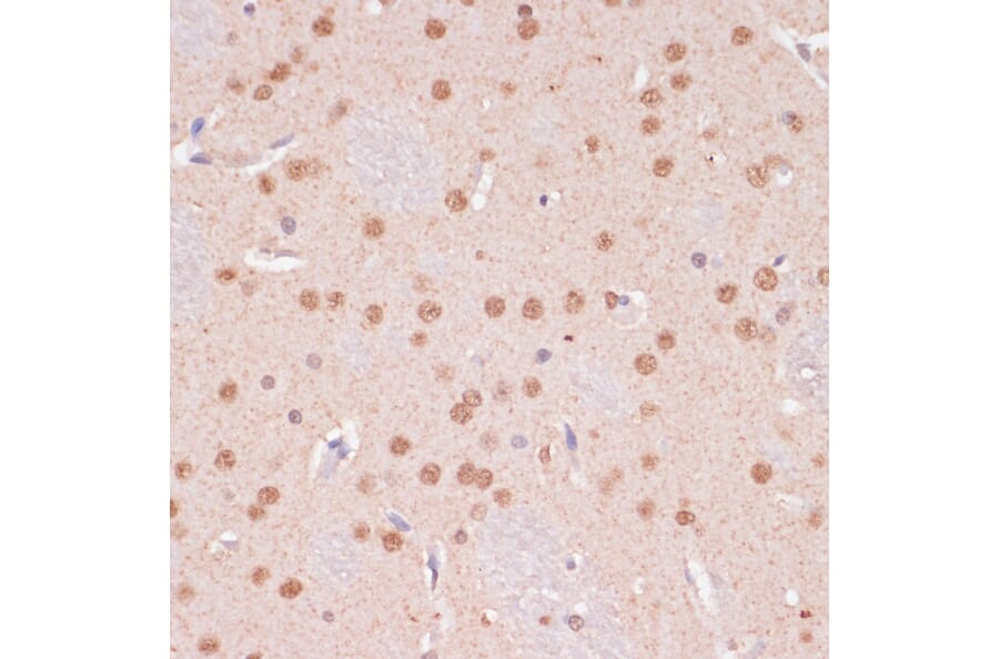Immunohistochemistry - Anti-KDM6B / JMJD3 Antibody (A88509) - Antibodies.com