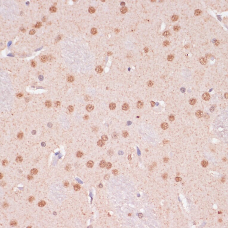 Immunohistochemistry - Anti-KDM6B / JMJD3 Antibody (A88509) - Antibodies.com
