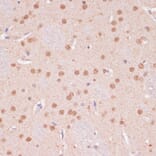 Immunohistochemistry - Anti-KDM6B / JMJD3 Antibody (A88509) - Antibodies.com