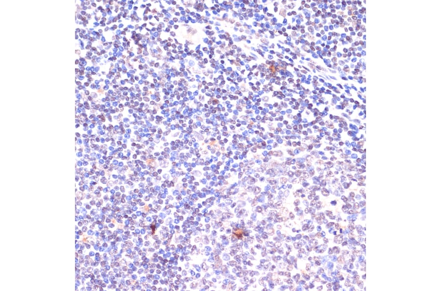 Immunohistochemistry - Anti-KDM6B / JMJD3 Antibody (A88509) - Antibodies.com
