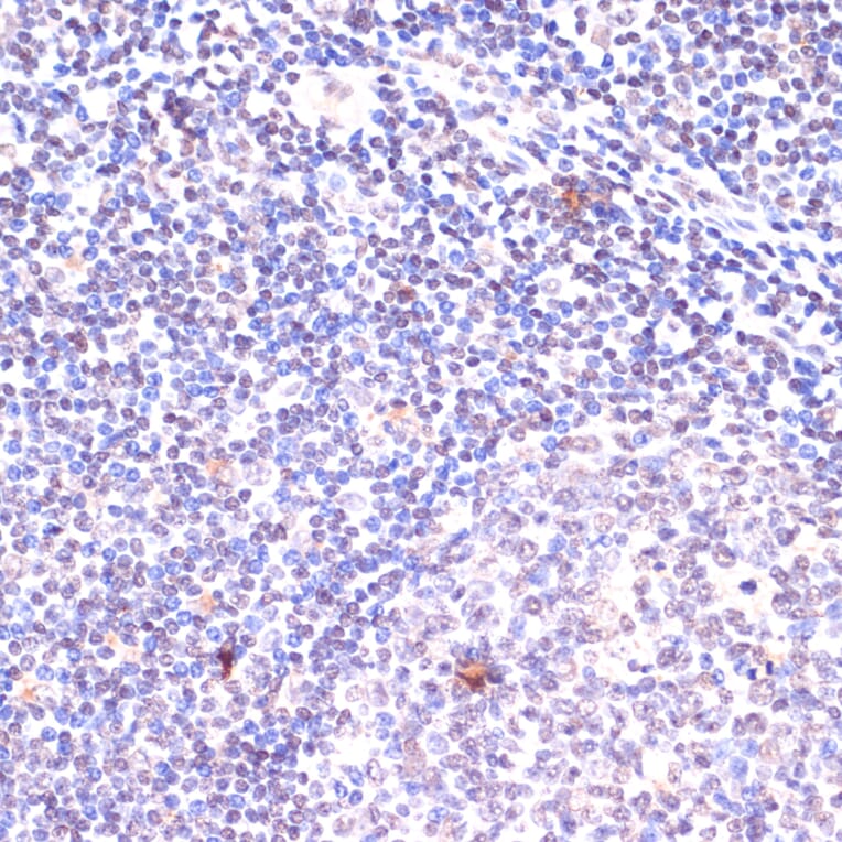 Immunohistochemistry - Anti-KDM6B / JMJD3 Antibody (A88509) - Antibodies.com