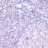 Immunohistochemistry - Anti-KDM6B / JMJD3 Antibody (A88509) - Antibodies.com