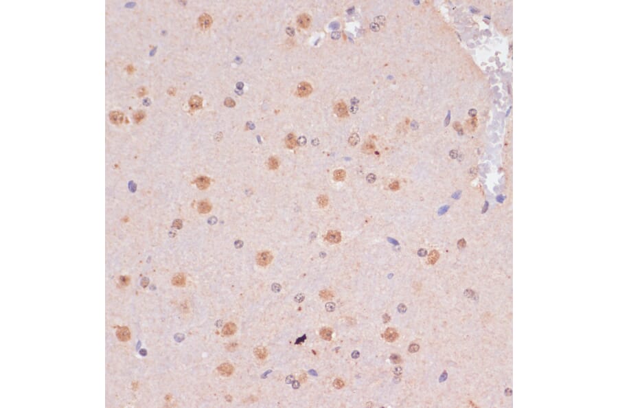 Immunohistochemistry - Anti-KDM6B / JMJD3 Antibody (A88509) - Antibodies.com