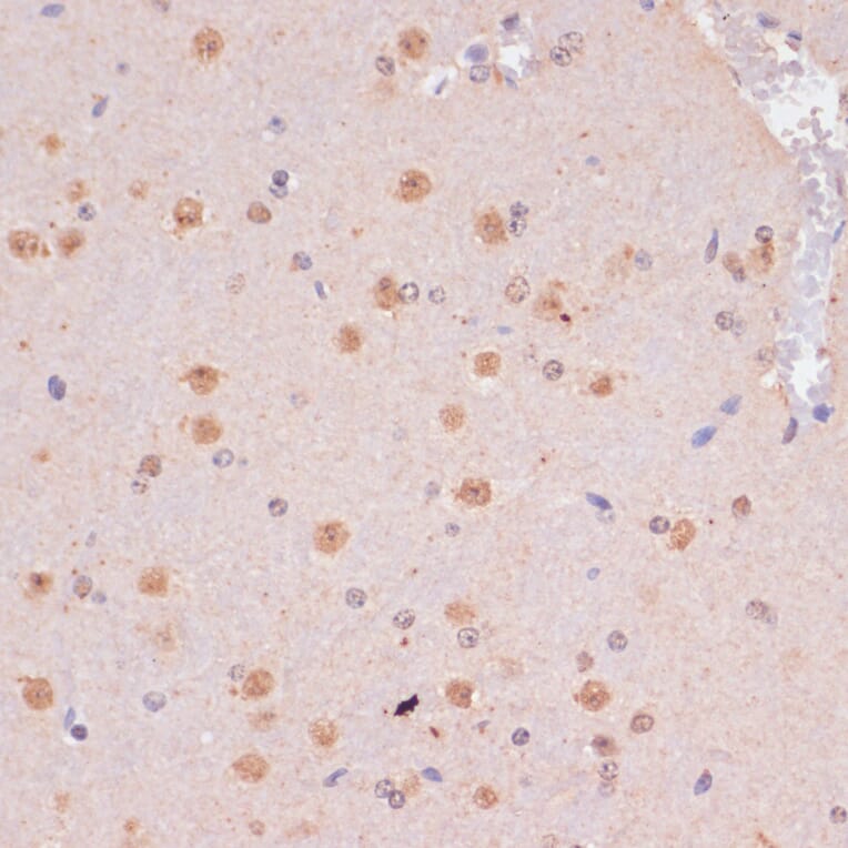 Immunohistochemistry - Anti-KDM6B / JMJD3 Antibody (A88509) - Antibodies.com